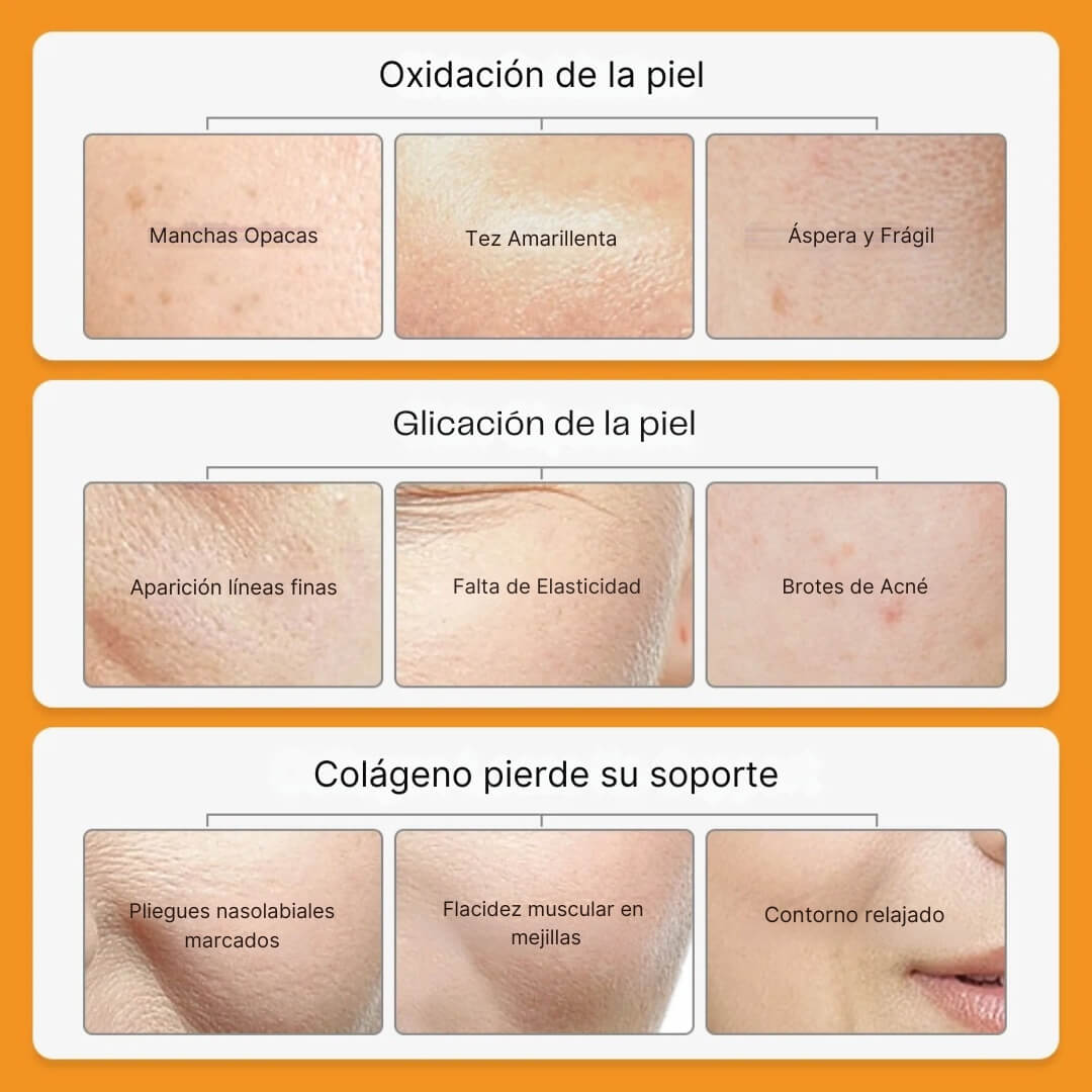 Kit 5 en 1 REJUVENECEDOR FACIAL Aclarante Vitamina C 🍊 (40% Dcto)